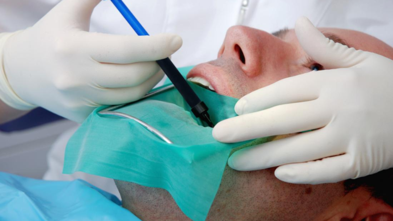 Comprehensive Dental Solutions: Navigating Root Canals and Full Mouth Reconstruction